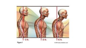postural shifting and anterior spinal distortion