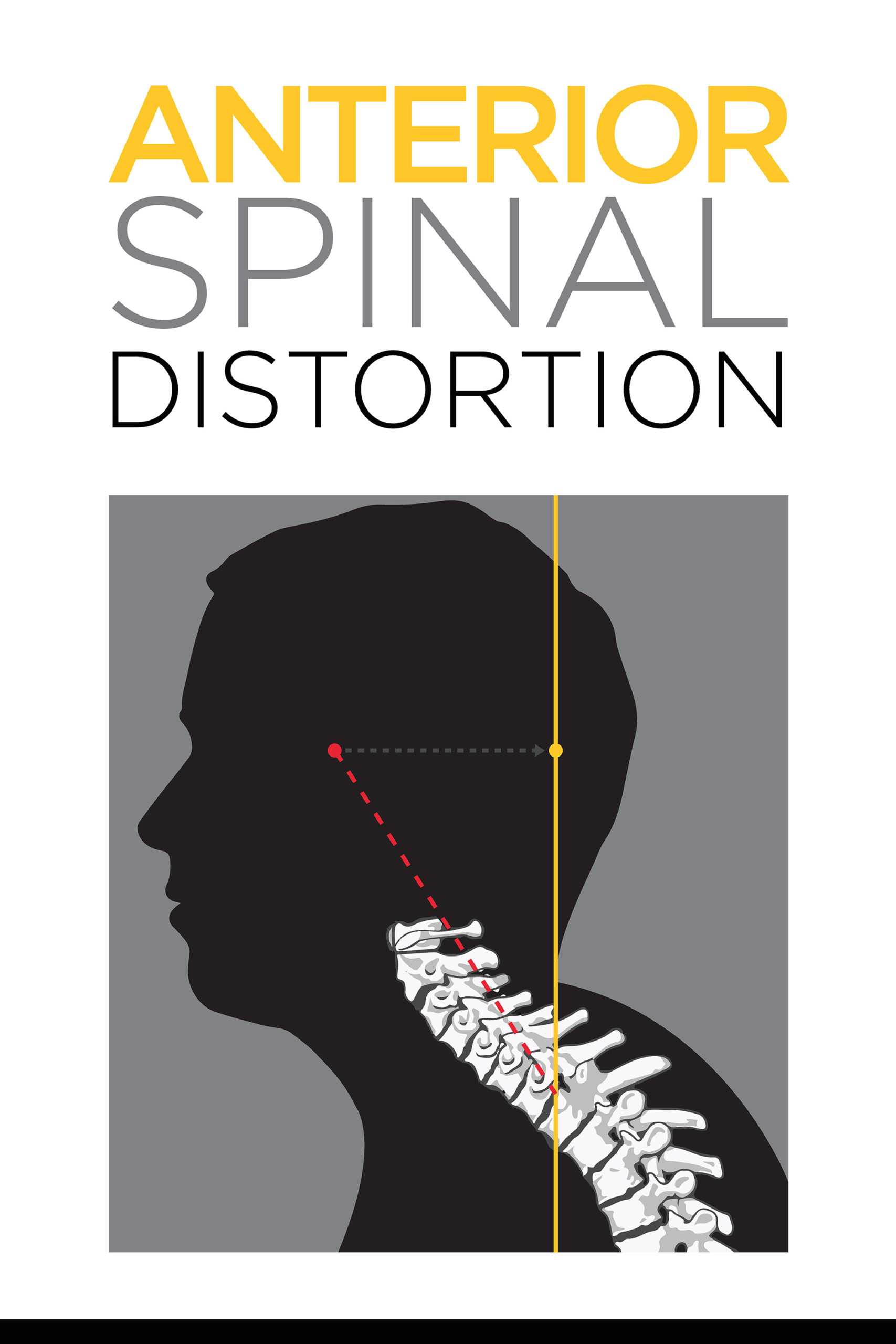 Picture of anterior spinal distortion and abnormal posture