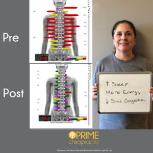 SEMG Analysis, core problems in the nervous system and spine